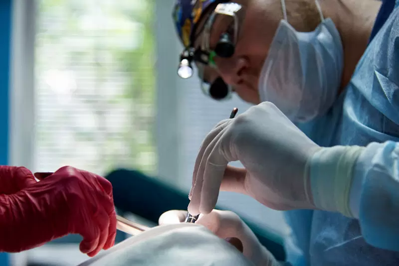 牙周整形手術_游離牙齦移植手術(補牙肉)