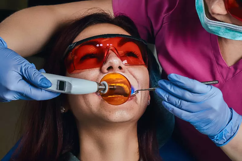 牙齒美白後注意事項