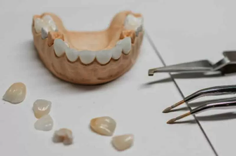 3D齒雕裝置後須知