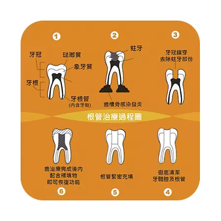 兒童牙科 兒牙療程