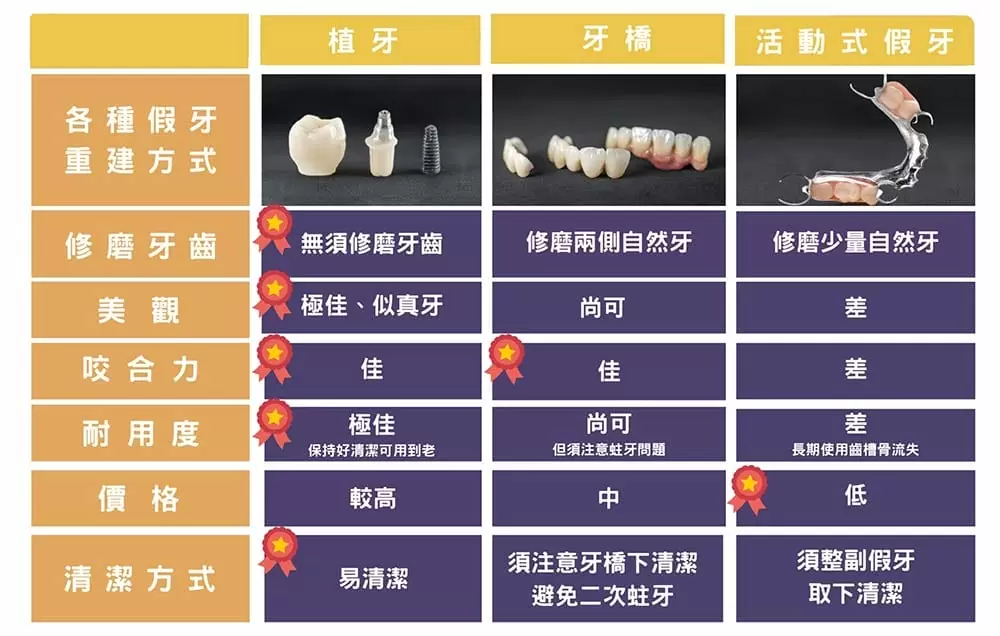 人工植牙 人工植牙