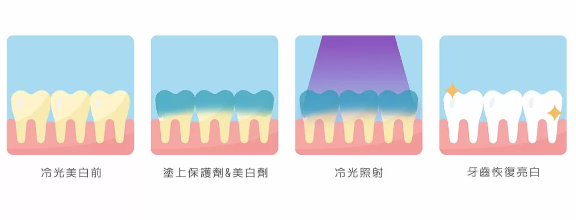 美容牙科 美容牙科