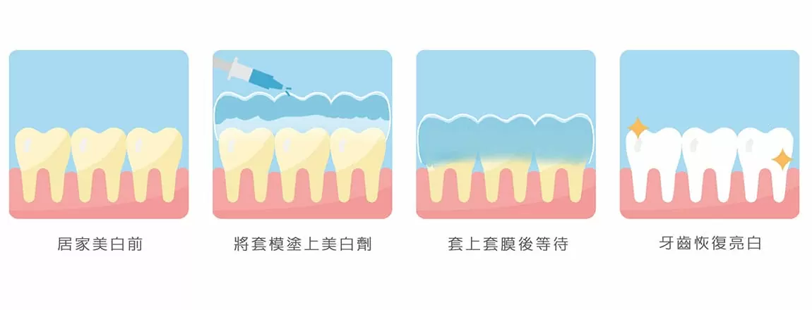 美容牙科 美容牙科