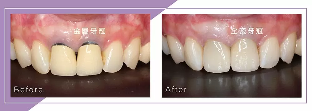 美容牙科 美容牙科