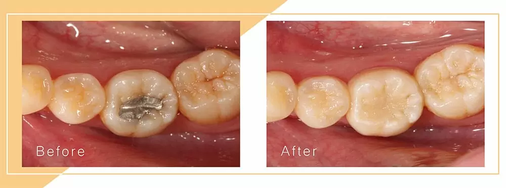 美容牙科 美容牙科